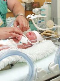 novorozenec v inkubátoru