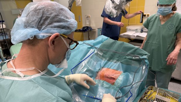 Lékaři ve Fakultní nemocnici v Motole vylepšili operace zavádějící kochleární implantát