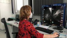 Lékařka Regina Šírová ukazuje snímek z unikátního 3D mamografu