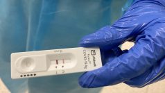 V nemocnici ve Slaném se potvrdila nákaza britskou mutací koronaviru