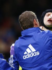 Lékař Chelsea ošetřuje brankáře Petra Čecha, který si v duelu proti Blackburnu zlomil nos