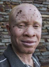 Bílá nosí smrt. Dokument o osudu albínů v africké Ghaně