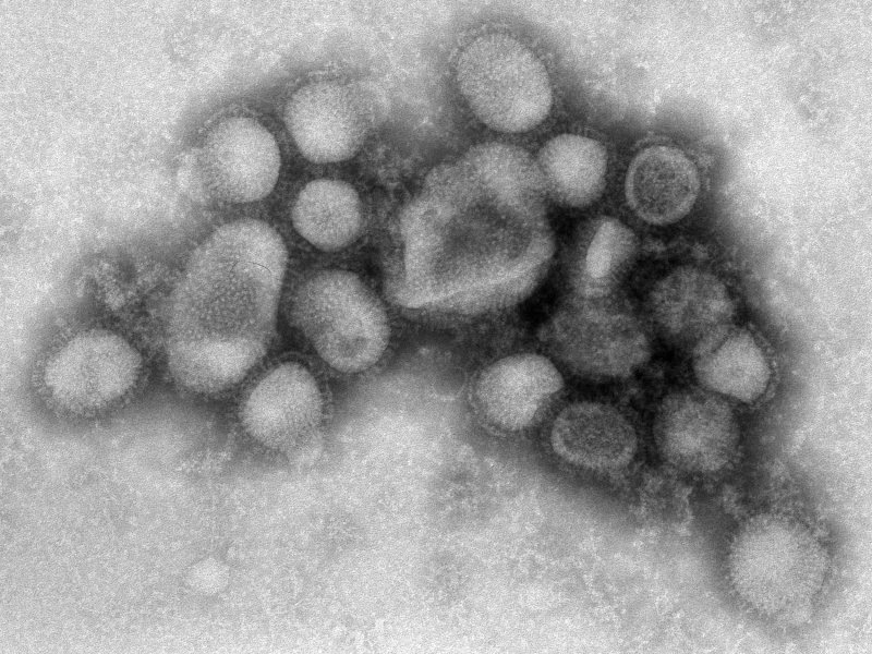 En farlig mutasjon av svineinfluensaviruset har dukket opp i Norge iRADIO