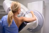 Klinika opominula výsledky vyšetření z mamografie, žena onemocněla rakovinou. Ilustrační foto.
