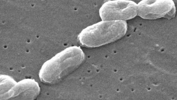 Bakterie Burkholderia cepacia, snímek ze skenovacího elektronového mikroskopu