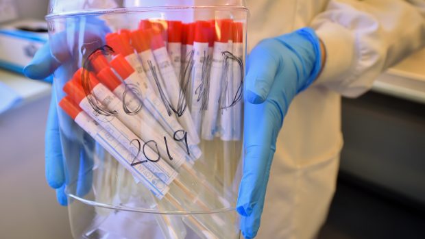 Vzorky od lidí, které experti testují na nemoc COVID-19, kterou nový typ koronaviru SARS-CoV-2 způsobuje