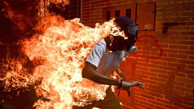 Nominace na vítěznou fotografii World Press Photo 2018 - Venezuelská krize. Demonstrant José Víctor Salazar Balza byl zraněn při střetech s policií během protestů proti prezidentu Nicolasi Madurovi.