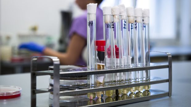 Vzorky v pražské Nemocnici Na Bulovce, kde se podezření na nákazu koronavirem nepotvrdilo
