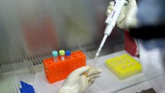 Vědec testuje vzorek na přítomnost nového koronaviru. (ilustrační foto)