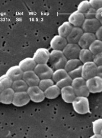 Acinetobacter baumannii