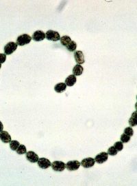 Sinice (kyanobakterie) Anabaena flosaquae - ilustrační foto