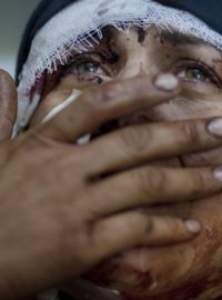 Zraněná žena z města Idlíb. Při zásahu Asadových jednotek na její dům byl zabit její manžel i dvě děti