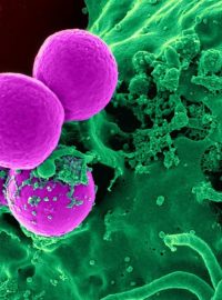 Lékaře znepokojují bakterie odolné vůči nejsilnějším antibiotikům (ilustrační foto)