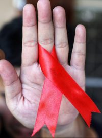 Léky na HIV jsou už dnes dostupné, před nemocí se lze bránit i preventivní léčbou