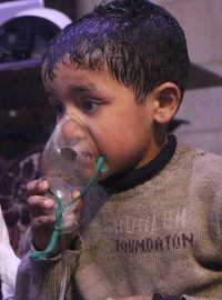 Děti ošetřované po chemickém útoku na Dúmá (7. dubna 2018).